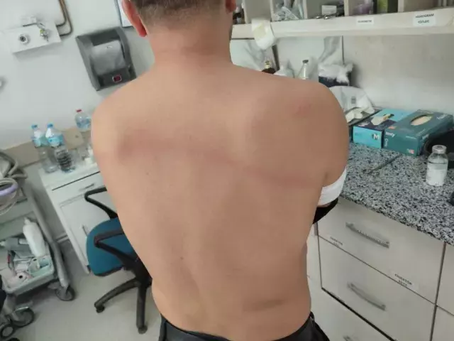 Chp Li Belediye Baskani Tas Dosemek Istemeyen 18993576 9869 M