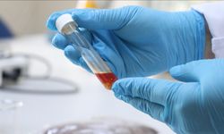 Tekirdağ'da üzüm atığından yüksek değerli tek hücre yağı üretildi