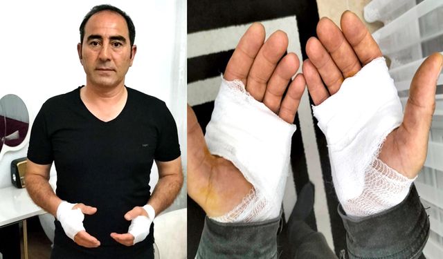 Köpeklerden kaçarken hastanelik oldu