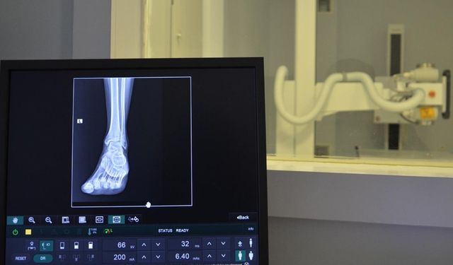 Hastaneye dijital röntgen cihazı kazandırıldı