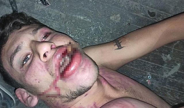 Hamam böceği yedirilen gencin dosyasında karar