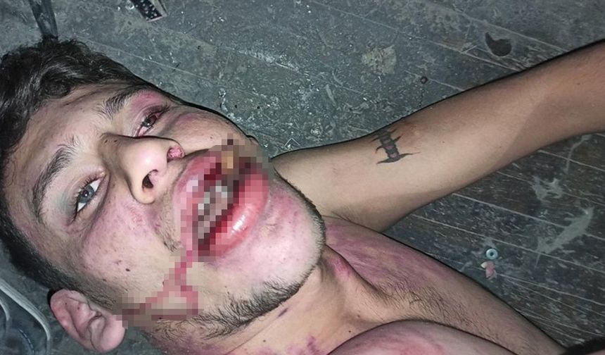 Hamam böceği yedirilen gencin dosyasında karar